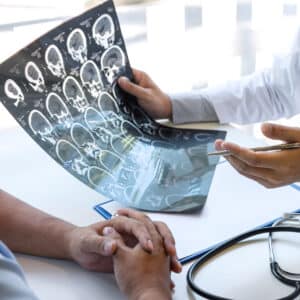 Un médico le muestra a su paciente una tomografía cerebral.